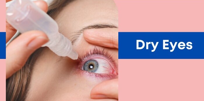 Dry Eyes problem and solution